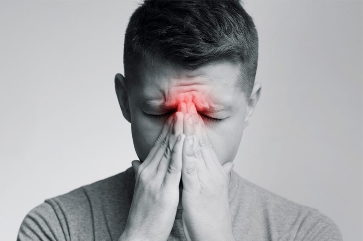 Nhiều bệnh nhân đau nhức đầu do mắc viêm xoang