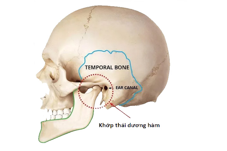 Nhiều người đau nhức đầu sau tai do rối loạn khớp thái dương hàm